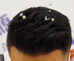 -大麦微针植发全国连锁