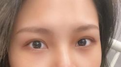 -广州美莱医疗美容医院