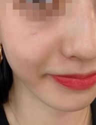 -广州曙光医学美容医院