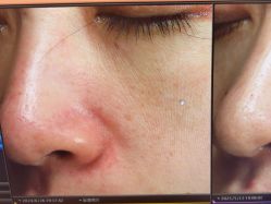 -苑苑vbeauty科技美容SPA
