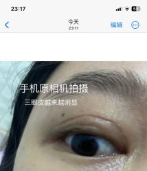 体验后-广州美莱医疗美容医院