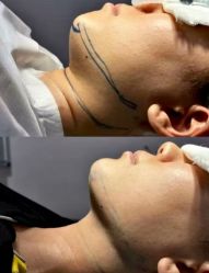 -东莞西妃整形美容医院