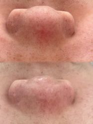 -skin79皮肤管理中心