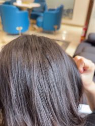 -碧莲盛·不剃发植发