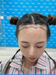 -雍禾植发全国连锁