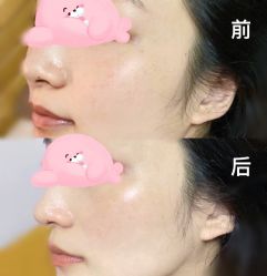 体验前-八大处整形