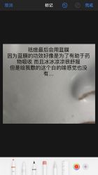 -痘博士北京·全国连锁祛痘机构