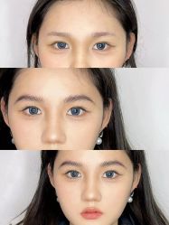 点击看大图 -杨益美学·野生眉半永久纹眉发际线