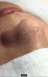 -苑苑vbeauty科技美容SPA