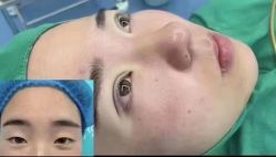 -郡艺医疗美容·微整·眼鼻吸脂