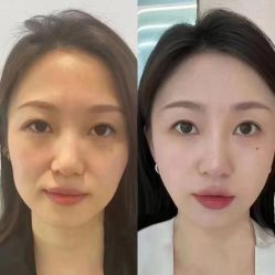 -LUNA皮相美·骨相美高级美感