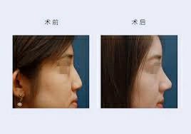 -SKINIST丽铂医疗美容