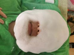 -苗方清颜·祛痘皮肤管理
