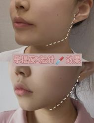 -上海漾颜医疗美容