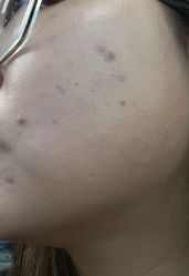 体验后-美莱医学美容医院