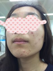 -皇族养心堂·净痘·修敏·御颜
