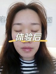 体验后-北京博泽医疗美容门诊部