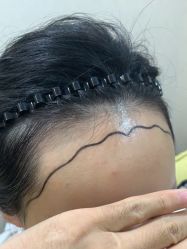 -熙朵美学植发·连锁品牌