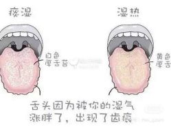 点击看大图 -姜美堂·蒸姜除湿の纤体美颜馆