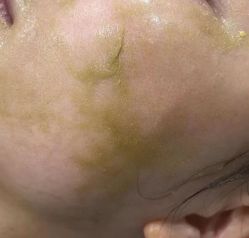 -skin79皮肤管理中心