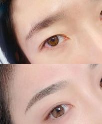 -郡艺医疗美容·微整·眼鼻吸脂