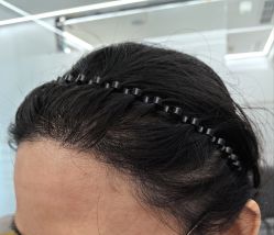 点击看大图 -熙朵美学植发·连锁品牌