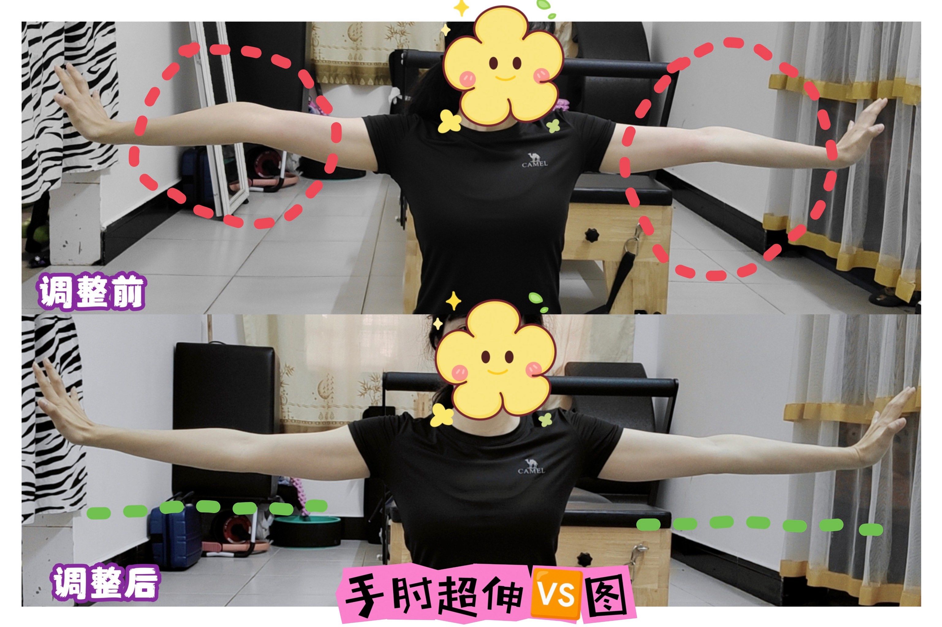 了
过程中,老师会一边纠正身体形态,我有前肘超伸和肋骨外扩的问题