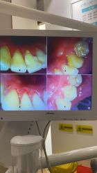 -万州华美紫馨整形美容医院