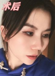 -素美医疗美容·西南眼鼻整形·修复基地