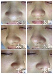 光SPA水氧+opt-光SPA科技美肤