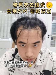 -雍禾植发全国连锁