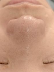 -SKIN79皮肤管理中心