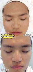 点击看大图 -SKIN79皮肤管理中心