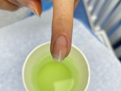 -Andrew指甲专科灰指甲·甲沟炎矫正·3D步态矫形鞋垫定制(上海法华镇路旗舰店)