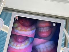 -深圳乐孚正强口腔诊所(宝体店)