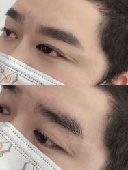 -德绣·机器野生眉发际线·美瞳线半永久