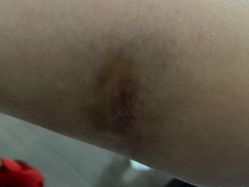 -成都军建医院·疤痕诊疗中心