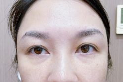 -天津健丽·去眼袋医疗美容机构
