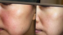 点击看大图 -苑苑vbeauty科技美容SPA