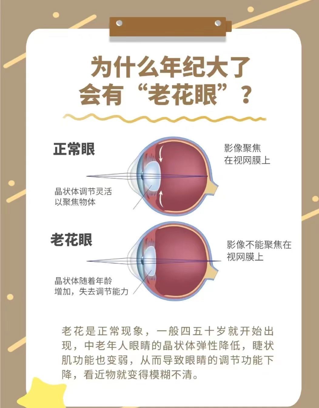 n一般四五十岁就开始出现老花眼
因个人的自身原因
出现老花眼