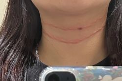 -美安心医美·美迪迈黄金微针·美拉美医疗美容
