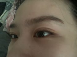 -悟空祛痘·诺奖技术专业店