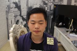 点击看大图 -大麦微针植发丨全国连锁