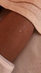 -肥三针腧穴瘦身馆