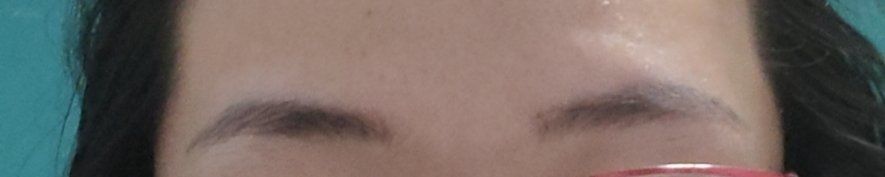 体验后-南宁华美医疗美容医院