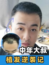 -雍禾植发