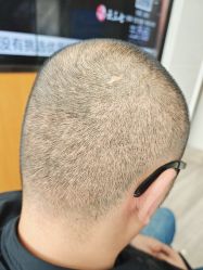 -雍禾植发全国连锁