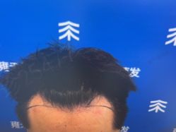 -雍禾植发全国连锁