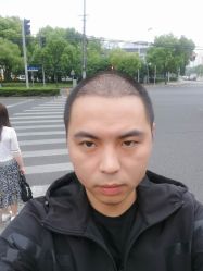 点击看大图 -大麦微针植发丨全国连锁