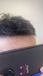 -发饰美男士增发补发假发定制店